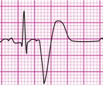 EKG Practice Test: Effective Study Plans and Schedules